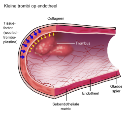 File:FIG00001.svg - THROMBOpedia